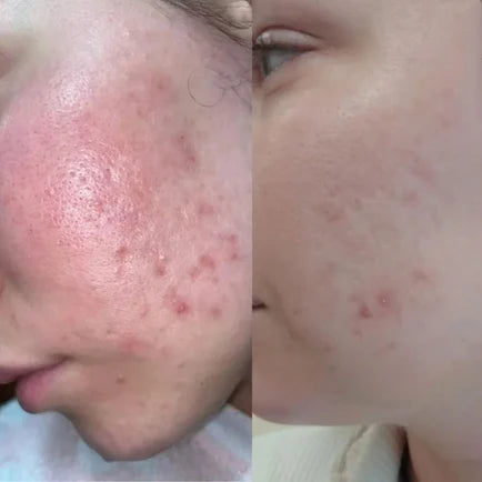 Retinol 0.5% In Squalane