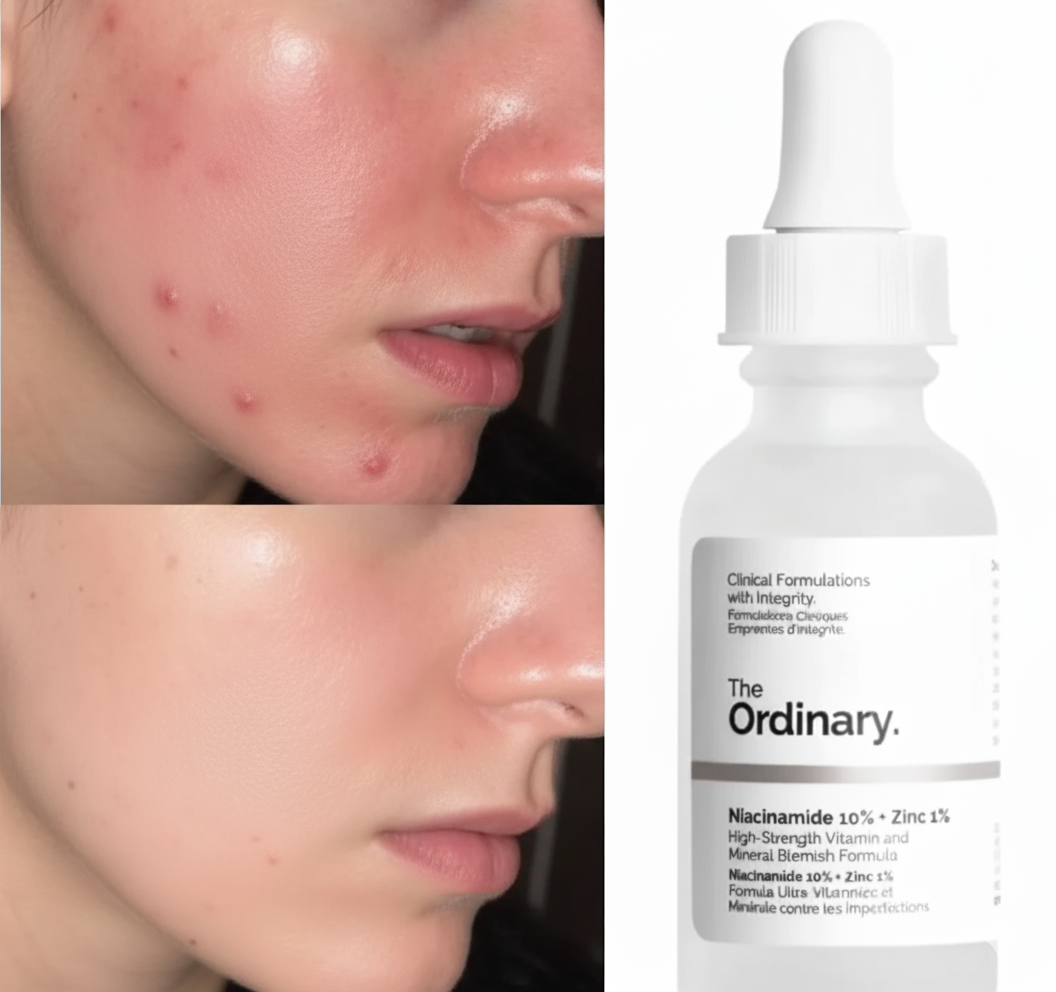 The Ordinary Niacinamide 10% + Zinc 1% Serum “100% original, imported from Canada”