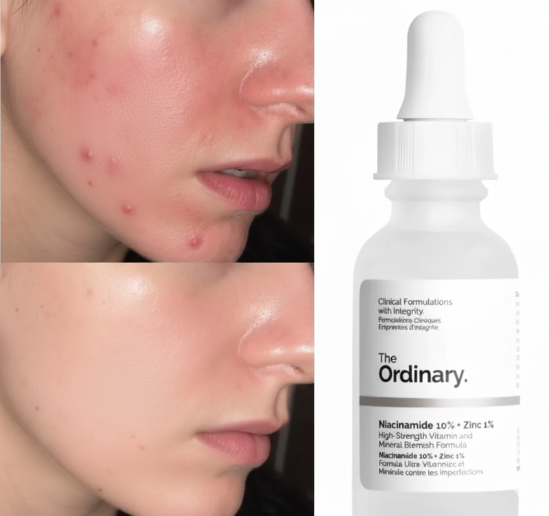 The Ordinary Niacinamide 10% + Zinc 1% Serum “100% original, imported from Canada”
