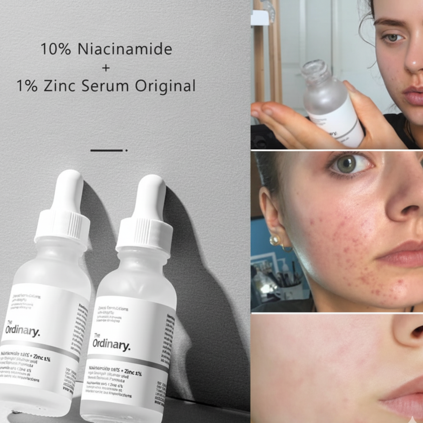 The Ordinary Niacinamide 10% + Zinc 1% Serum “100% original, imported from Canada”