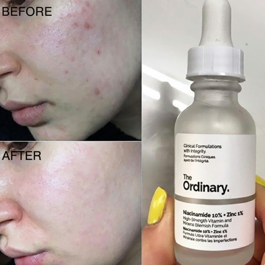 The Ordinary Niacinamide 10% + Zinc 1% Serum “100% original, imported from Canada”